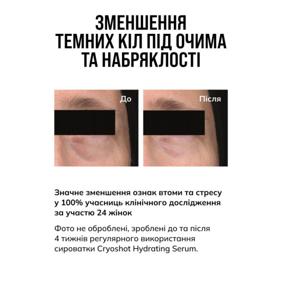 Зволожувальна сироватка /...