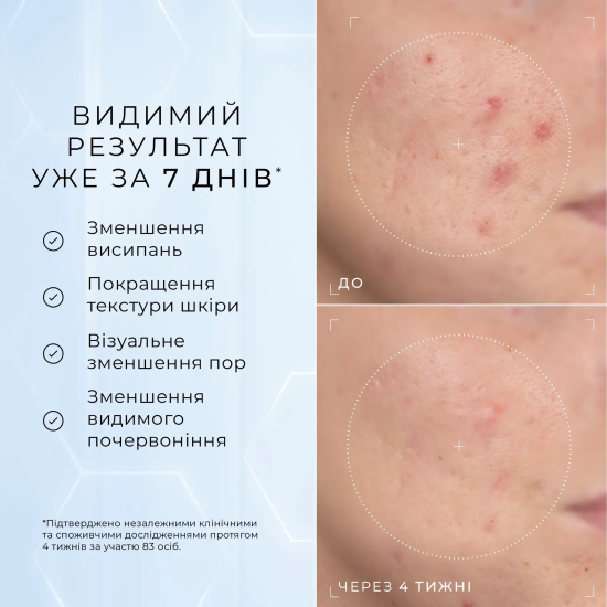 Пептидная сыворотка c 10%...